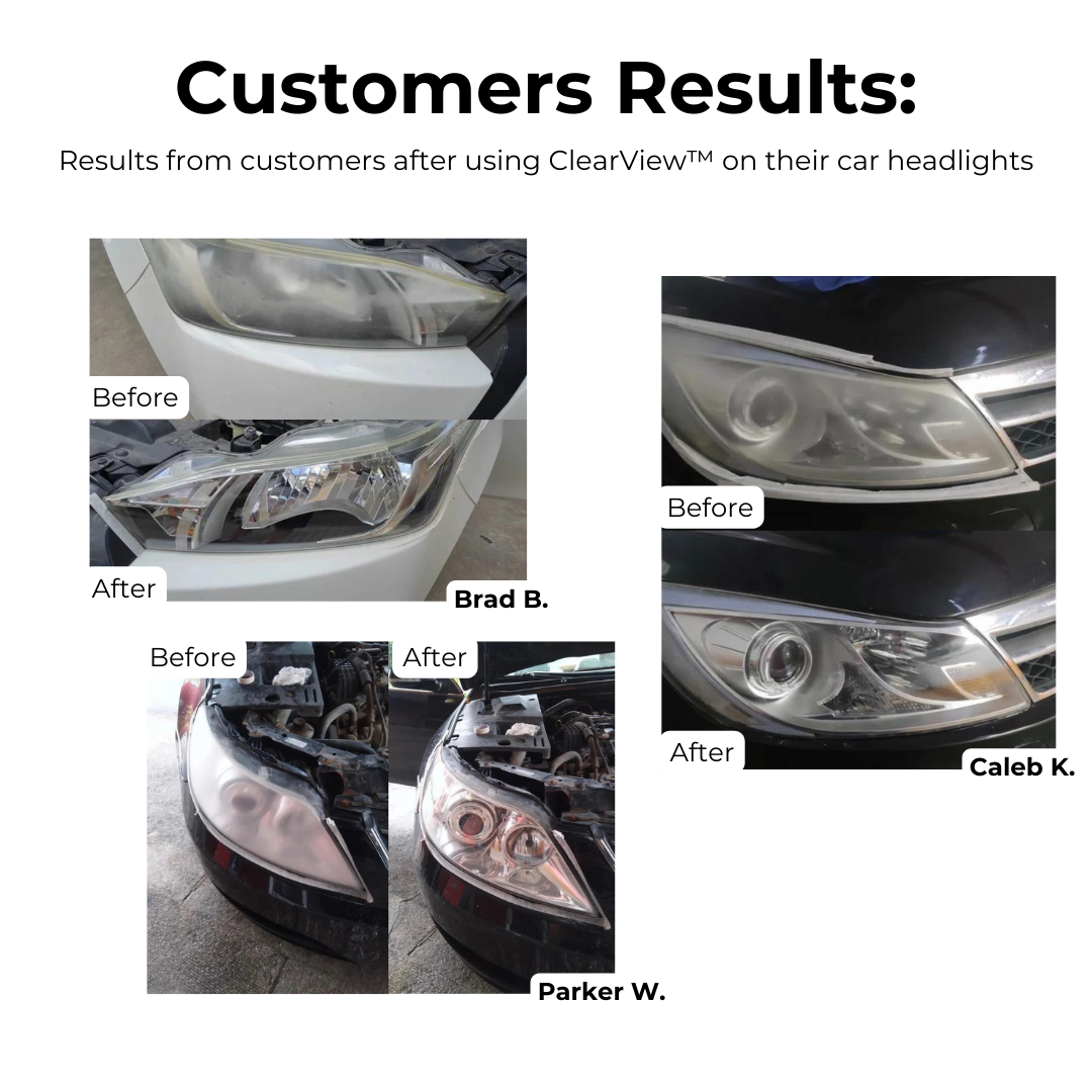 Last Day 1+1 FREE🔥 | ClearView™ Headlight Repair Fluid