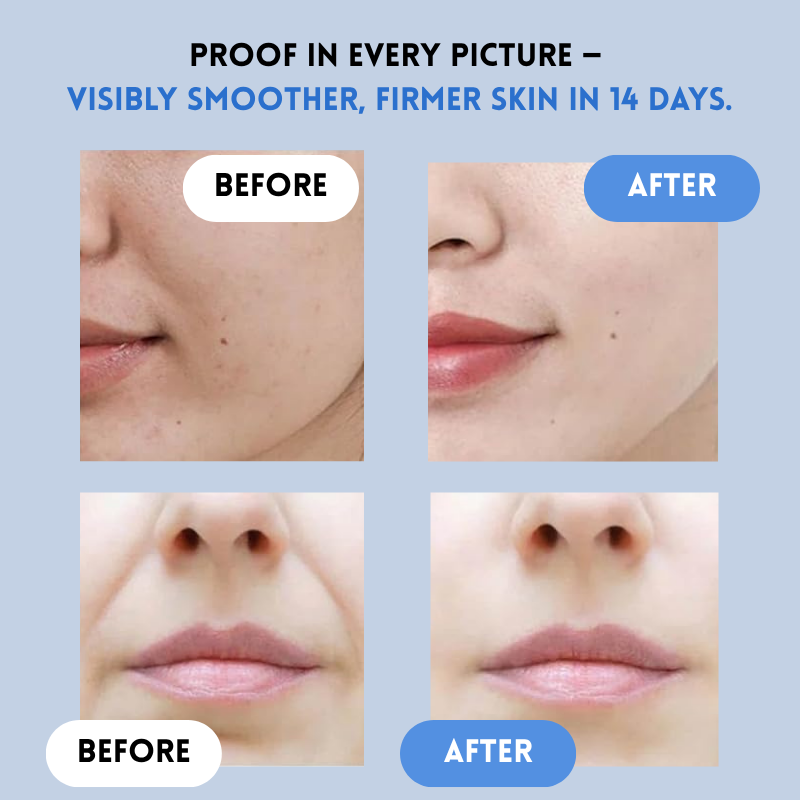 YouthLift Renew Strips – The Instant Solution for Timeless Beauty