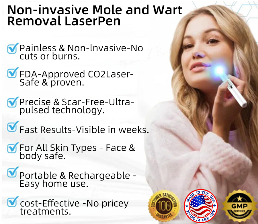 Vermoila® Non-Invasive Mole and Wart Removal Laser Pen Promax