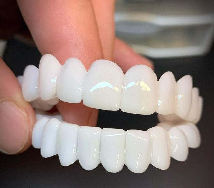 100% Adjustable Invisible Whitening Braces - No Holes