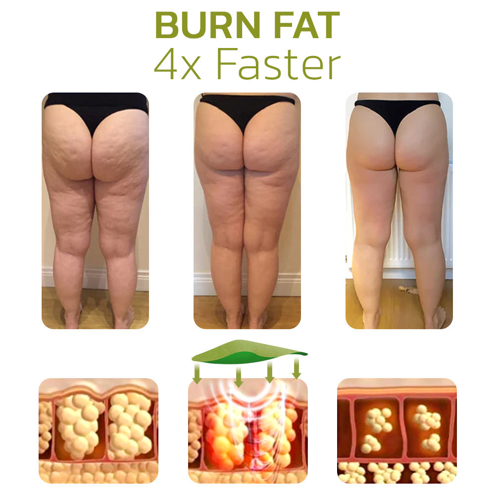 CelluSmooth™ Cellulite Reduction Solution