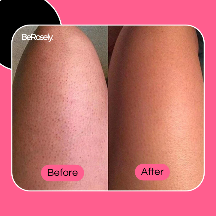 RadiantSkin™ Soft Shower Brush