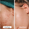 WrinkleAway™ Hydrated Wrinkle Reduction