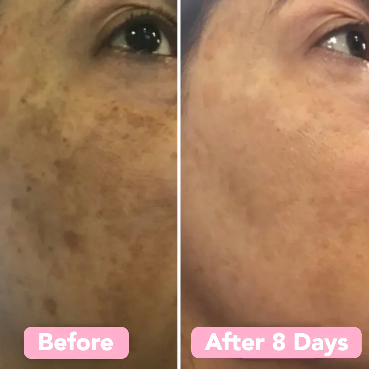 Fade Dark Spots Fast – Velleara Turmeric & Kojic Acid Pads