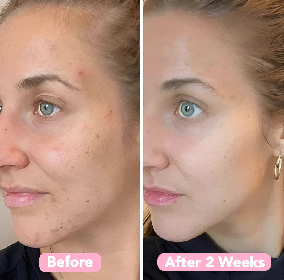 Fade Dark Spots Fast – Velleara Turmeric & Kojic Acid Pads