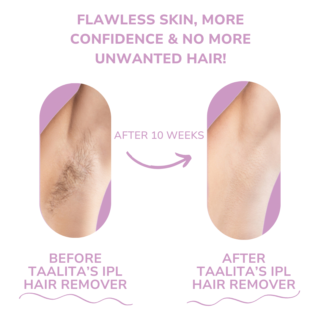GlowSmooth™ Pain-Free Hair Removal