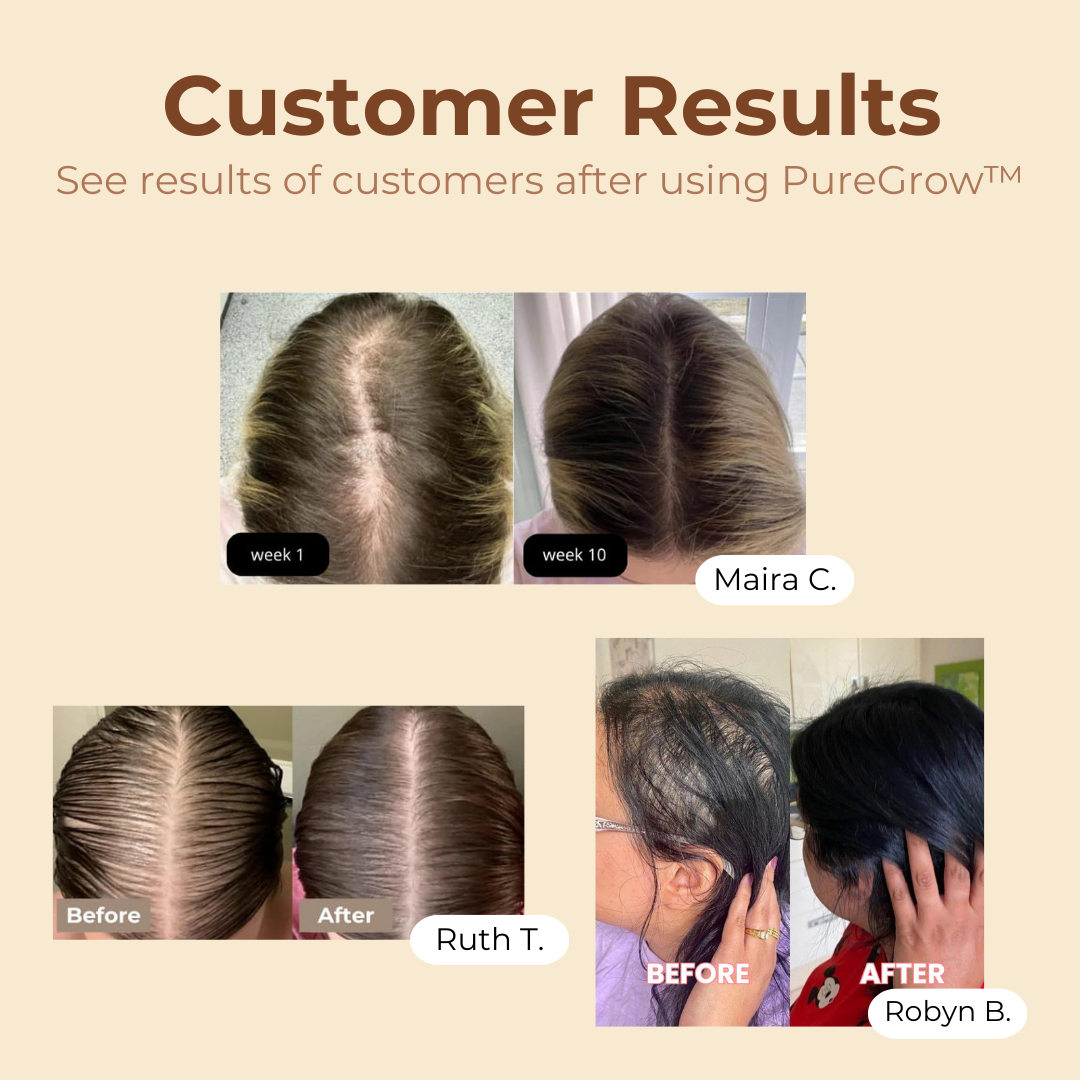 PureGrow™ Organic Batana Oil I Last Day 50% OFF🔥