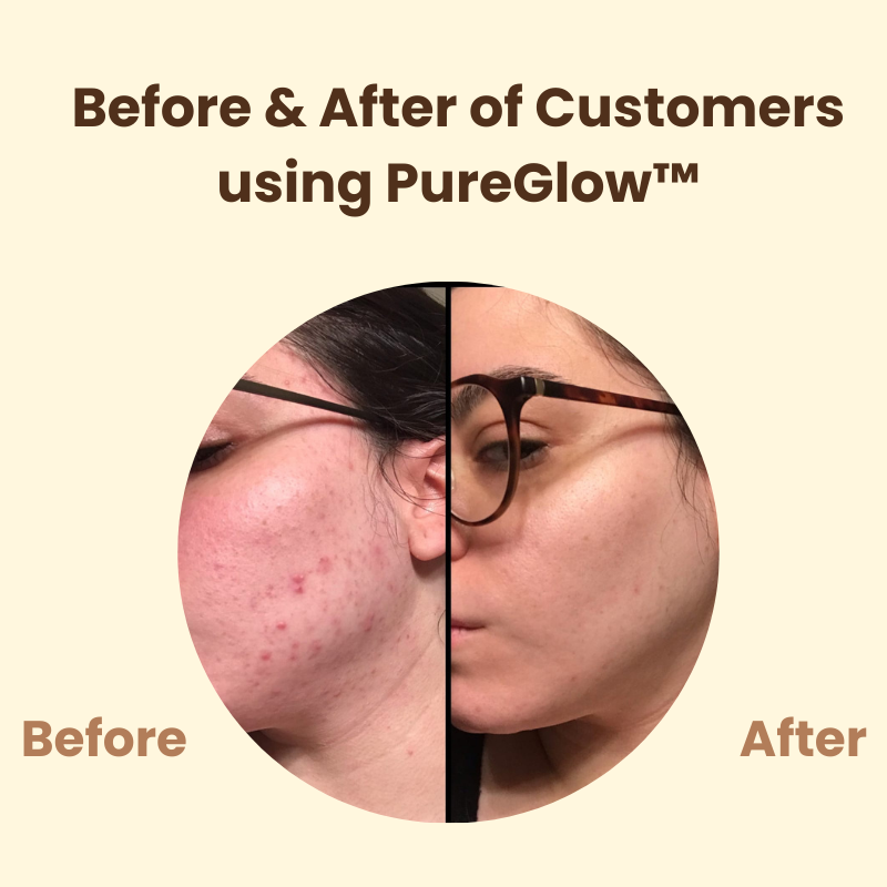 Last day 50% off | PureGlow™ Black Tea Mask