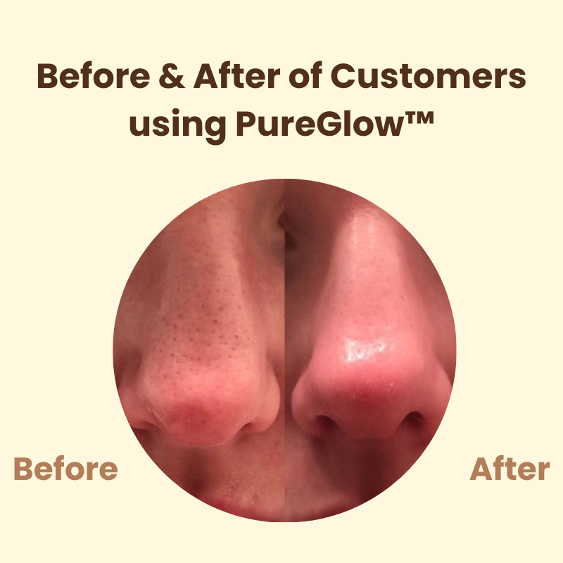 Last Day 1+1 FREE | PureGlow™ Black Tea Mask