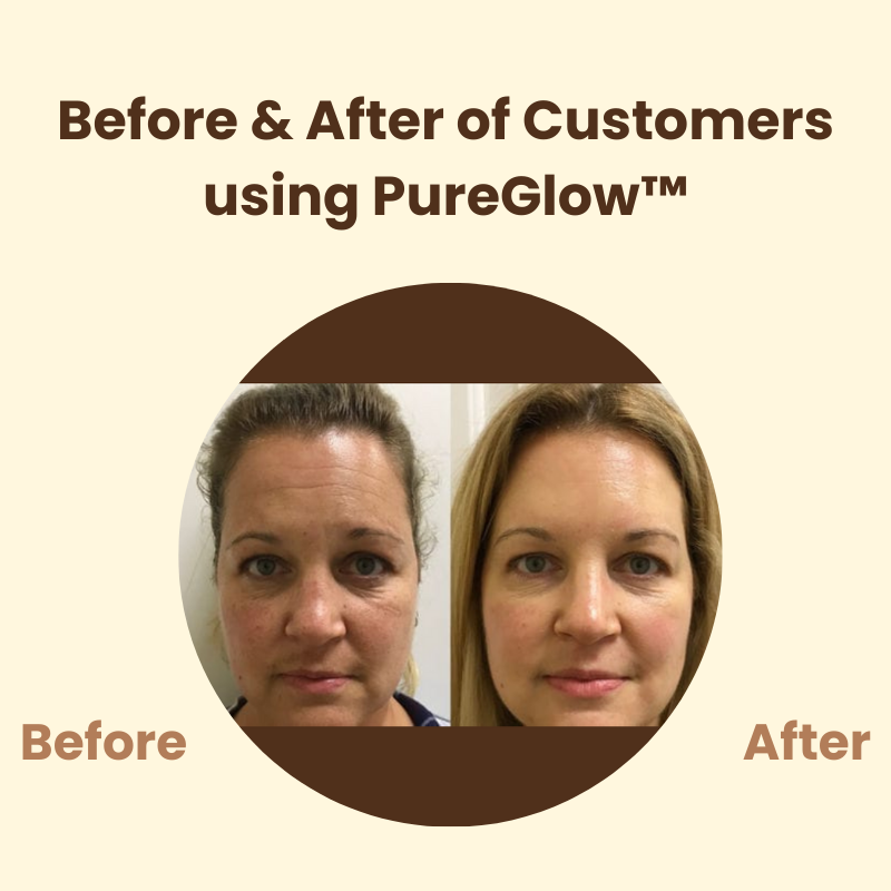 Last day 50% off | PureGlow™ Black Tea Mask