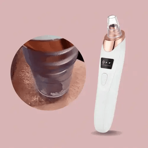 PoreGlow™ Blackhead Remover