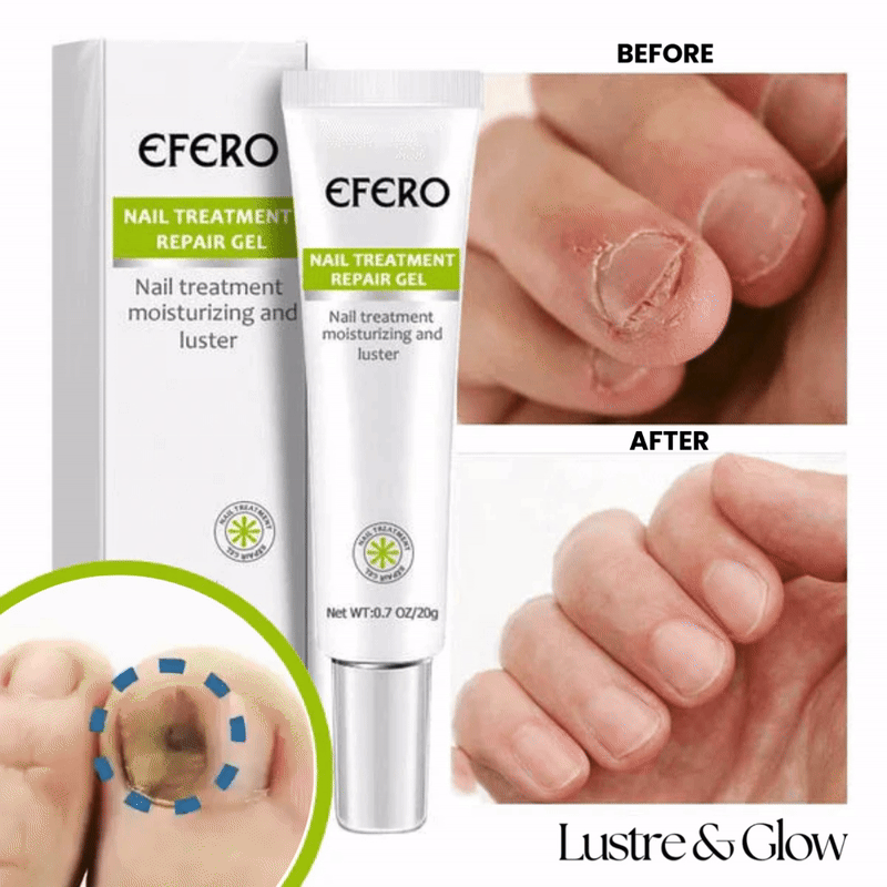 60% OFF | Evolvo™ Nail Repair Gel