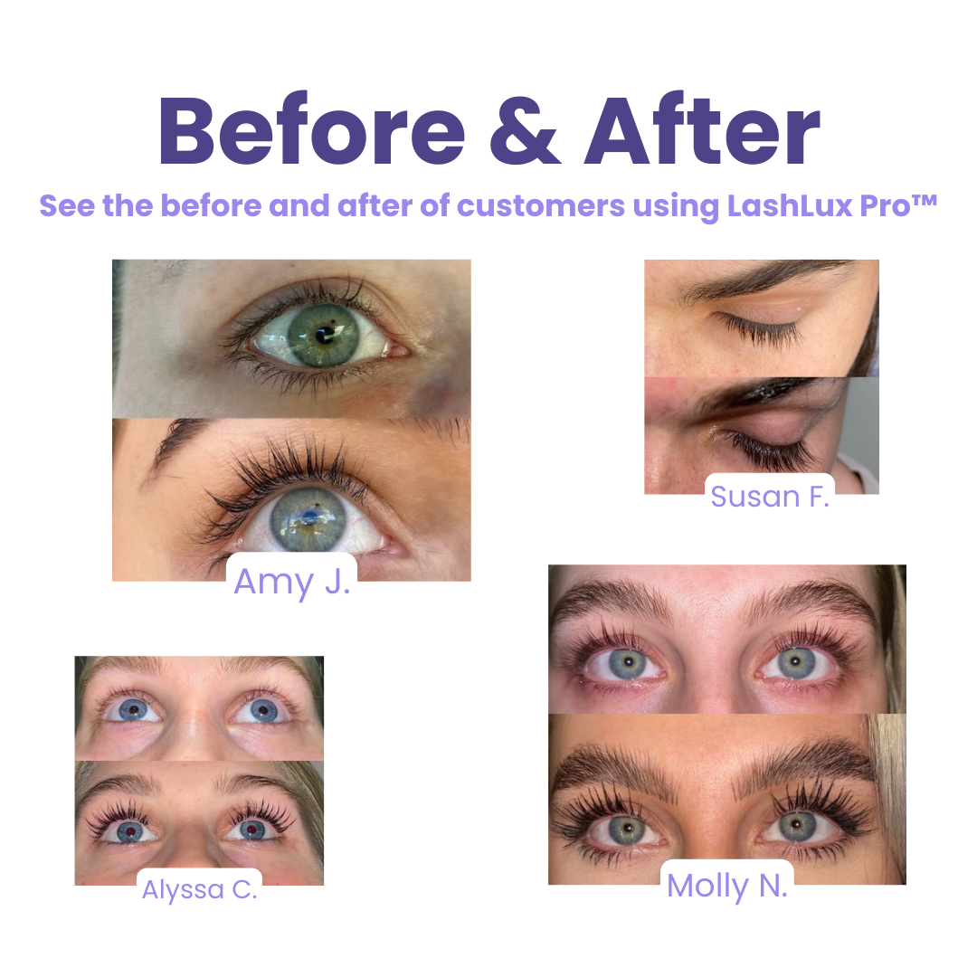 Last Day 1+1 FREE🔥 | LashLux Pro™ Lash Growth Serum