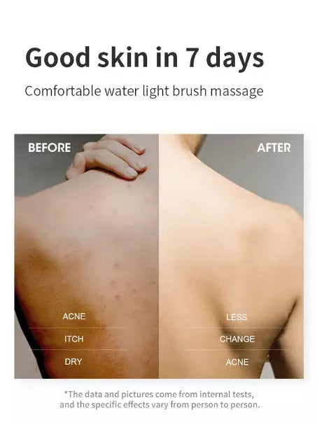 SpaGlow™ Gentle Skin Renewal